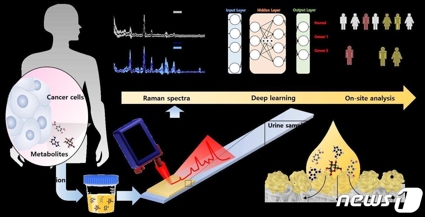 한국재료연구원 정호상 박사 연구팀이 공동개발한 전립선암과 췌장암을 진단할 수 있는 스트립형 소변 센서 진단 과정.(재료연 제공)