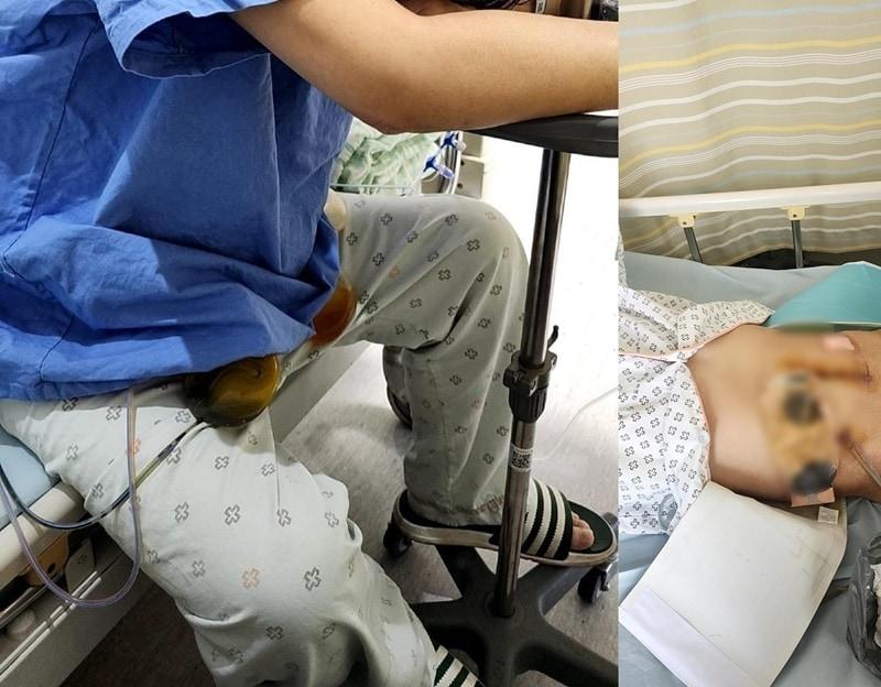 본문 이미지 - (보배드림 갈무리)