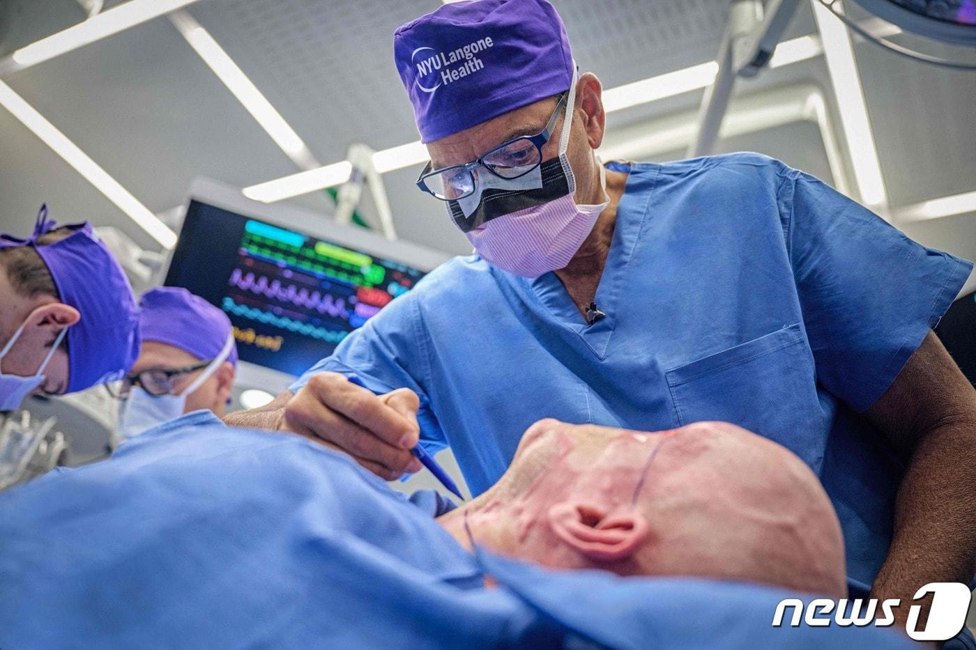 2023년 5월27일 뉴욕대 랭건병원에서 공개한 사진이다. 에두아르도 로드리게스 의사가 세계 최초로 안구와 안면 이식 수술을 하고 있다. ⓒ AFP=뉴스1