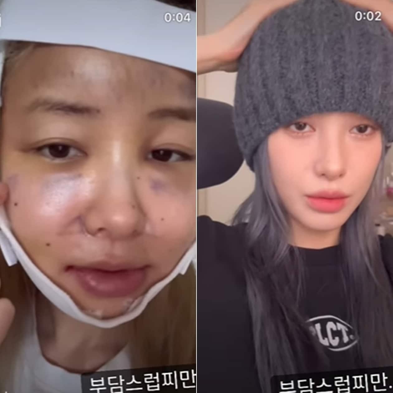 본문 이미지 - 인플루언서 유깻잎 인스타그램 갈무리