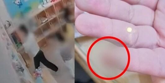 본문 이미지 - 교사가 무릎을 굽혀 꾹 닫은 문에 아이의 손가락이 잘려나갔다. (MBC 갈무리)