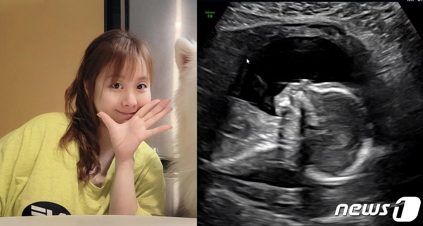 본문 이미지 - (노희지 인스타그램 갈무리) /뉴스1