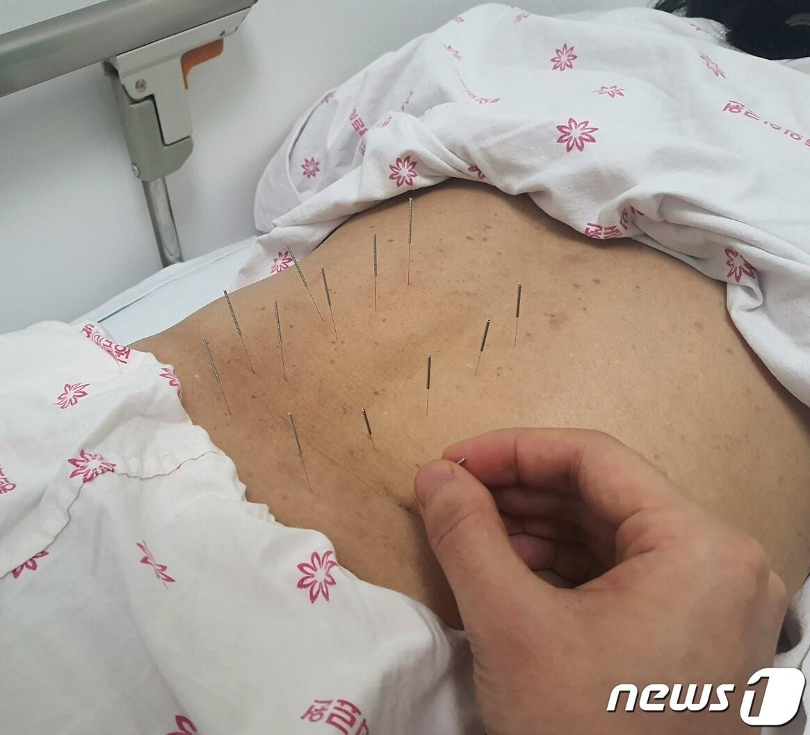 본문 이미지 - 요통 침치료. (한의학연구원 제공)/뉴스1