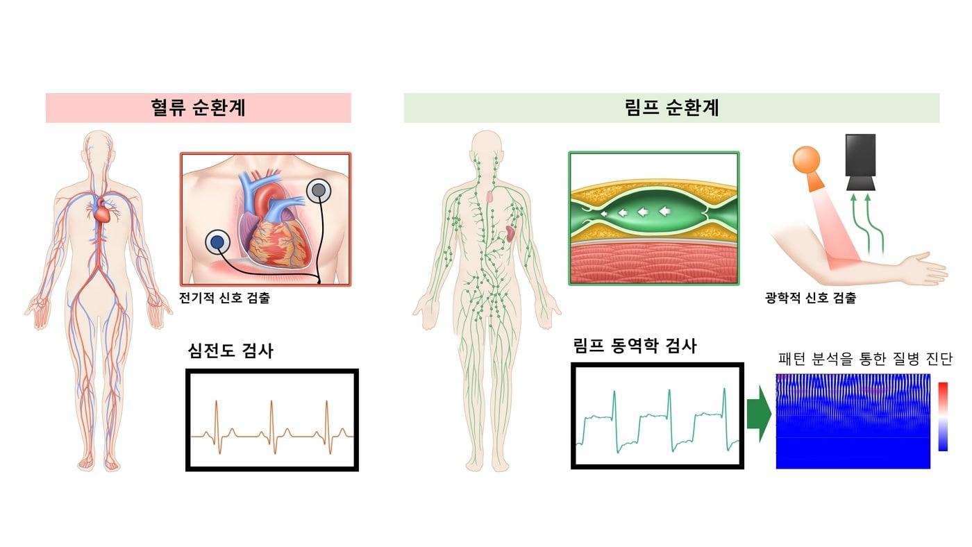 심전도 검사와 림프 동역학 검사 비교. (서울아산병원 제공)