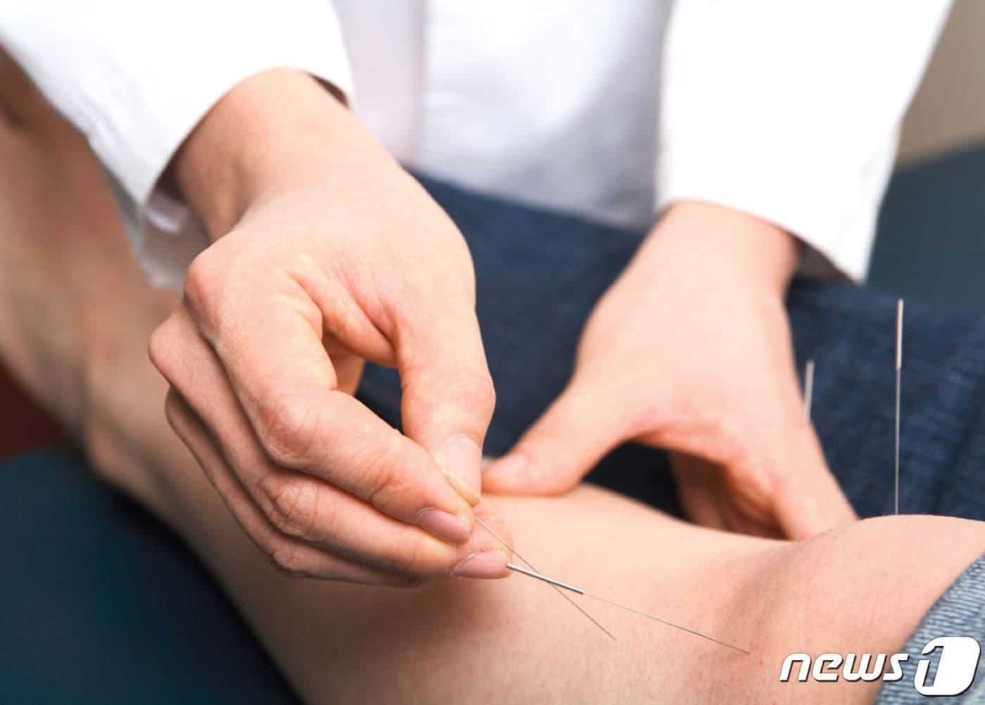 본문 이미지 - 의료진이 침치료를 시행하고 있다.(자생한방병원 제공)