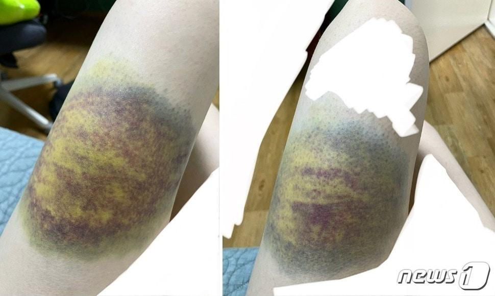 본문 이미지 - (온라인 커뮤니티 갈무리)