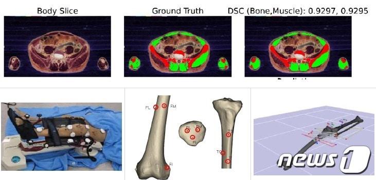 본문 이미지 - 휴먼 디지털 트윈 제작을 위한 자동화된 구획화 및 뼈대 마커 부착을 통한 관절 움직임 측정.(KISTI 제공)/뉴스1
