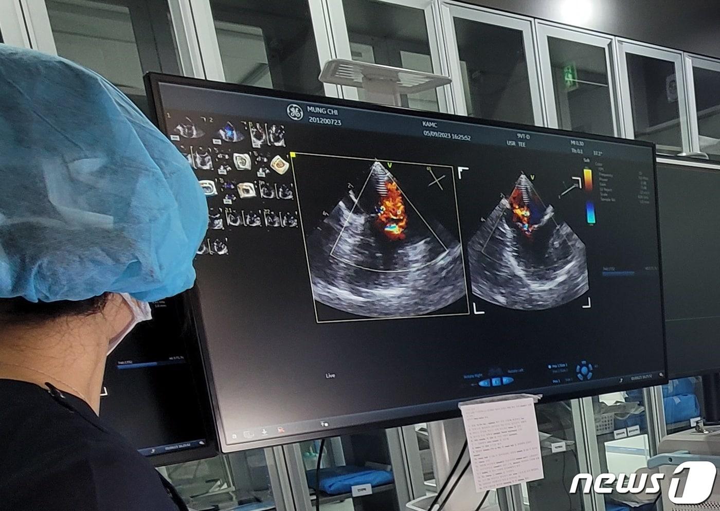 반려동물 심장병 치료를 위한 브이클램프 수술을 진행하고 있는 의료진(고려동물메디컬센터 제공) ⓒ 뉴스1