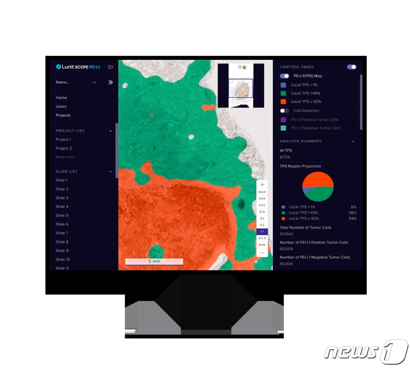 본문 이미지 -  루닛의 AI 기반 병리분석 솔루션 '루닛 스코프 PD-L1' 모습.