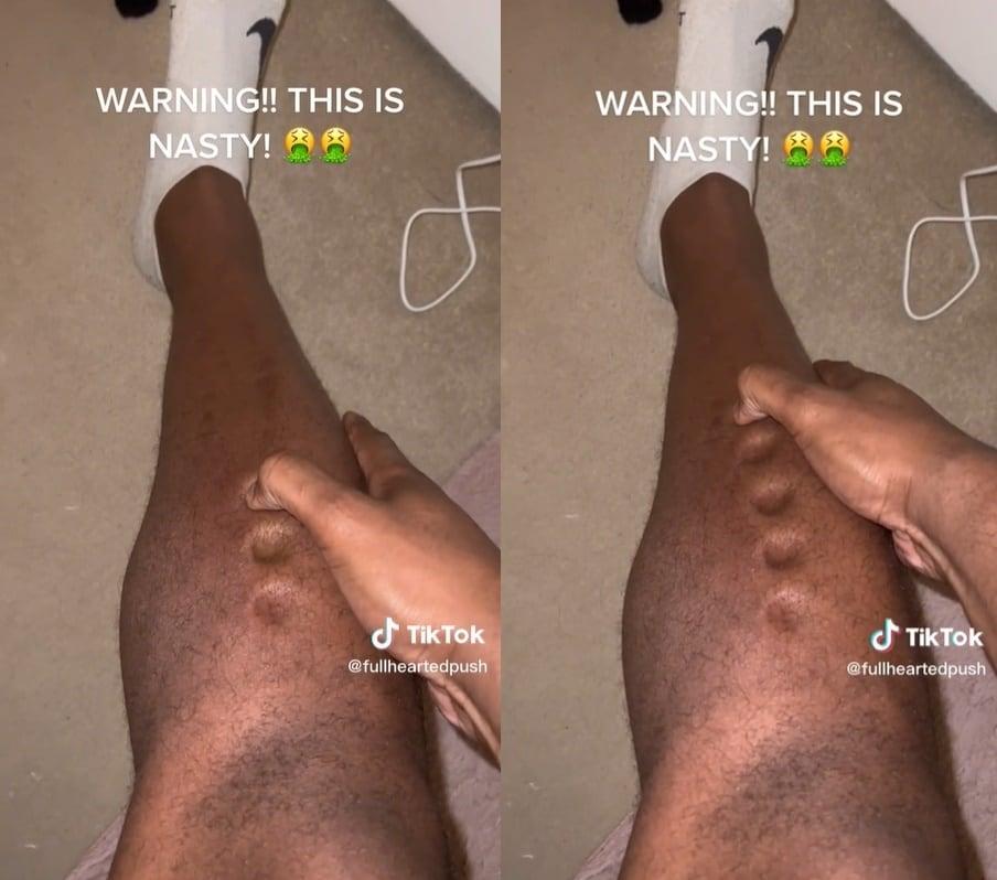 본문 이미지 - 오코예가 엄지손가락으로 자신의 정강이를 누르고 있는 모습. (로렌스 오코예 틱톡 갈무리)