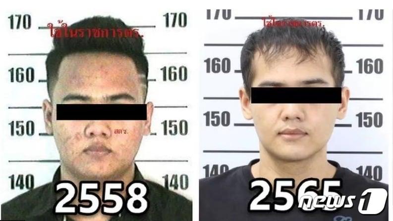본문 이미지 - 왼쪽은 수술 전, 오른쪽은 수술 후 - 타이 경찰 배포