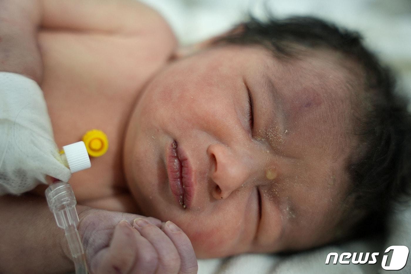 7일(현지시간) 시리아 북부 알레포 아프린에서 강진으로 무너진 아파트 건물에서 태어난 여자아이. 타박상을 입고 이마 부위에 멍이 들어있다. 2023.2.7 ⓒ AFP=뉴스1 ⓒ News1 정윤미 기자