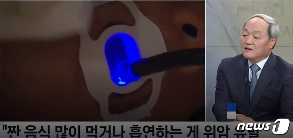 본문 이미지 - 위암수술의 세계적 권위자인 노성훈 연세대 특임교수가 16일 YTN에 출연해 짠 음식, 구이를 좋아하는 우리나라 식습관을 바꿀 필요가 있다고 했다. 또 찌개를  한그릇에 담아 나눠먹는 문화도 버려야 한다고 주문했다. (YTN 갈무리) ⓒ 뉴스1 