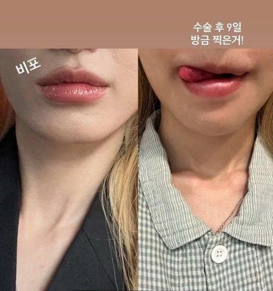 본문 이미지 - 사진=유깻잎 인스타그램