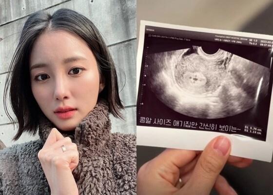 본문 이미지 - 사진=신지수 인스타그램