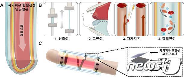 본문 이미지 - 인공혈관으로 적용 가능한 자가치유 항혈전성 소재 모식도.(연세대 제공)/뉴스1