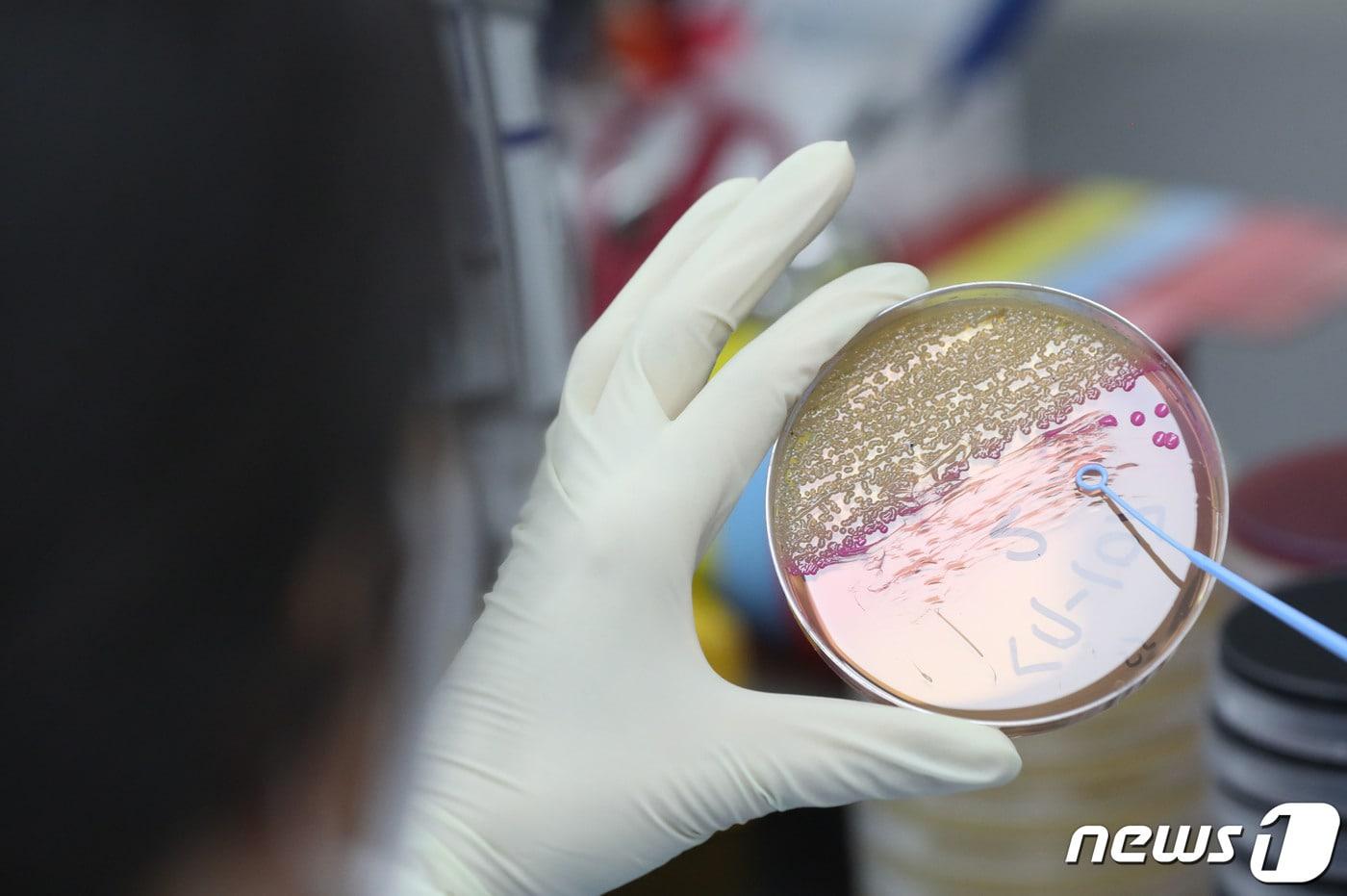 식중독균 배양검사. /뉴스1