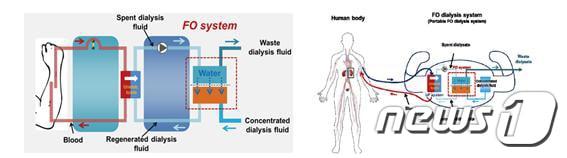 본문 이미지 - 신장질환과 투석기기 고도화 선도연구센터 그래픽.(전남대 제공)/뉴스1