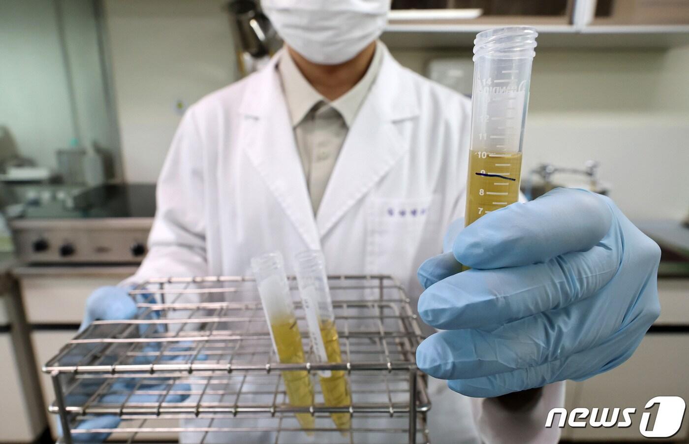 마약류 무료 익명검사를 시행한 28일 서울 강남구 보건소에서 임상병리사가 소변이 담긴 병을 들고 검사하고 있다.. 2023.8.28/뉴스1 ⓒ News1 김성진 기자