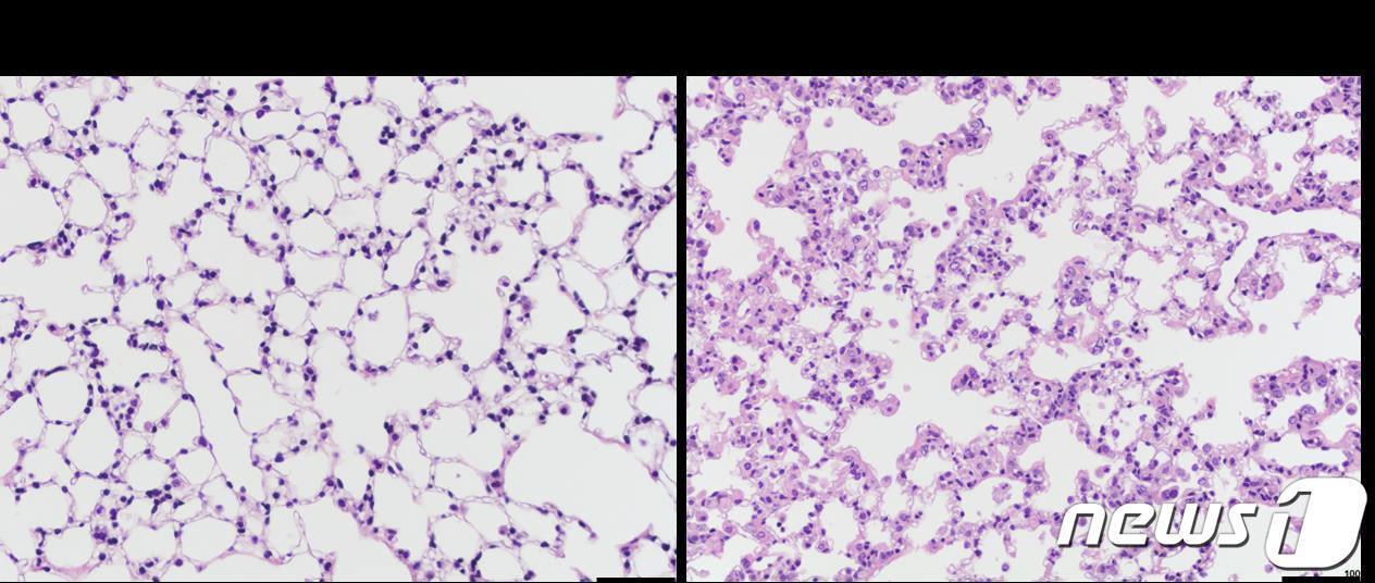 본문 이미지 - 미토콘드리아 기능 저하에 따른 쥐의 폐조직 변화. (한승혜 노스웨스턴대 교수 제공)/뉴스1