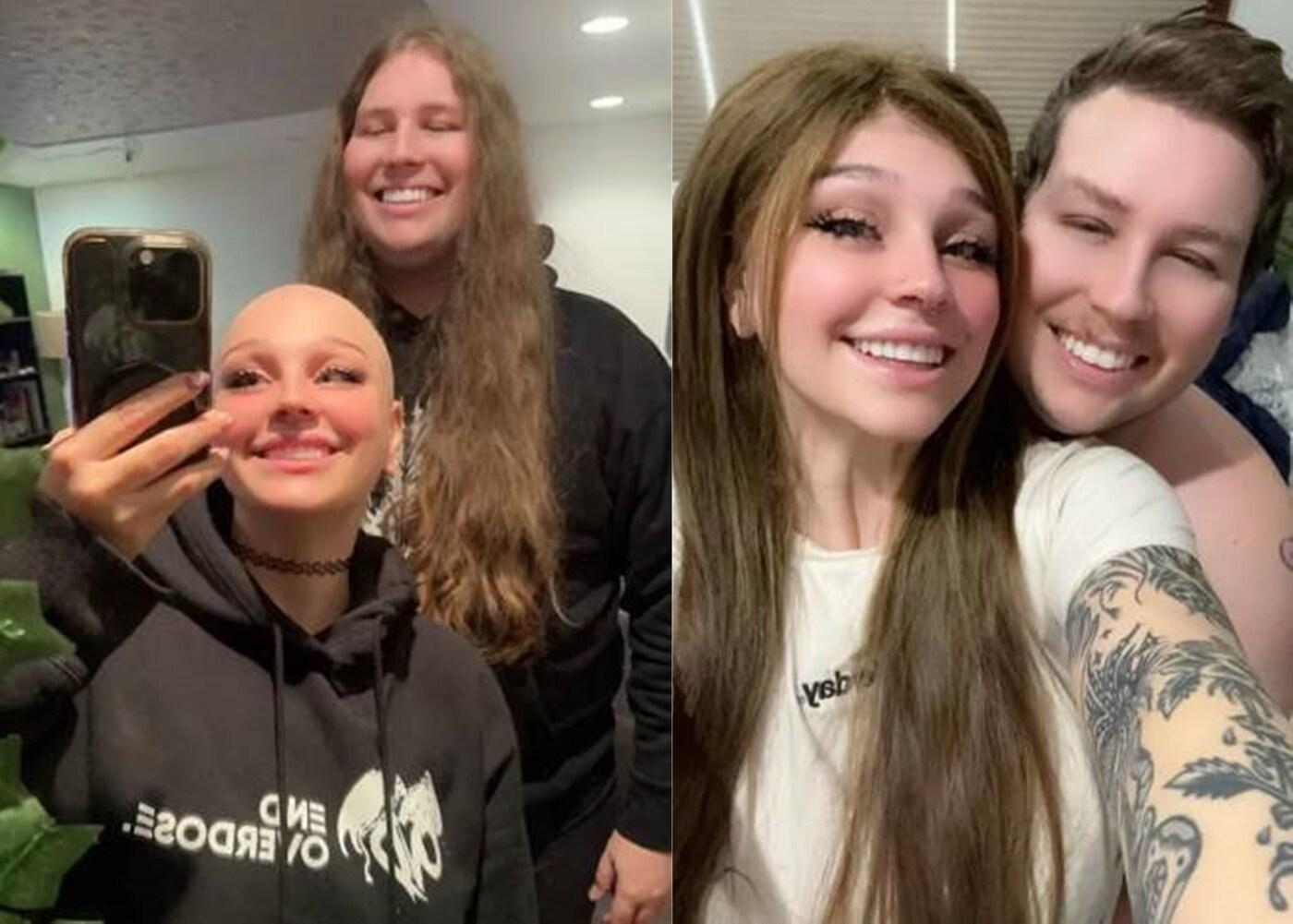 본문 이미지 - 탈모로 힘들어하는 연인을 위해 4년간 기른 자신의 머리를 가발로 만들어 선물한 한 남성의 사연이 감동을 안기고 있다. 뉴욕포스트 갈무리