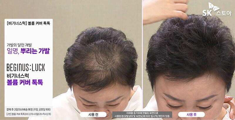 본문 이미지 - '비기너스럭 볼륨 탈모 톡톡' 방송 이미지(SK스토아 제공)