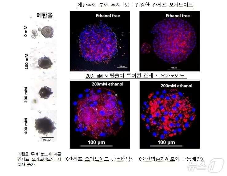 본문 이미지 - 농촌진흥청은 돼지 간세포 오르가노이드를 이용해 알코올성 지방간 모형을 재현하는 데 성공했다고 14일 밝혔다. 돼지 간세포 오르가노이드&#40;미니 장기&#41; 관련 사진&#40;농진청 제공&#41; 2024.10.14/뉴스1