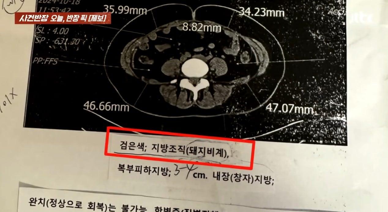 본문 이미지 - &#40;JTBC &#39;사건반장&#39;&#41;