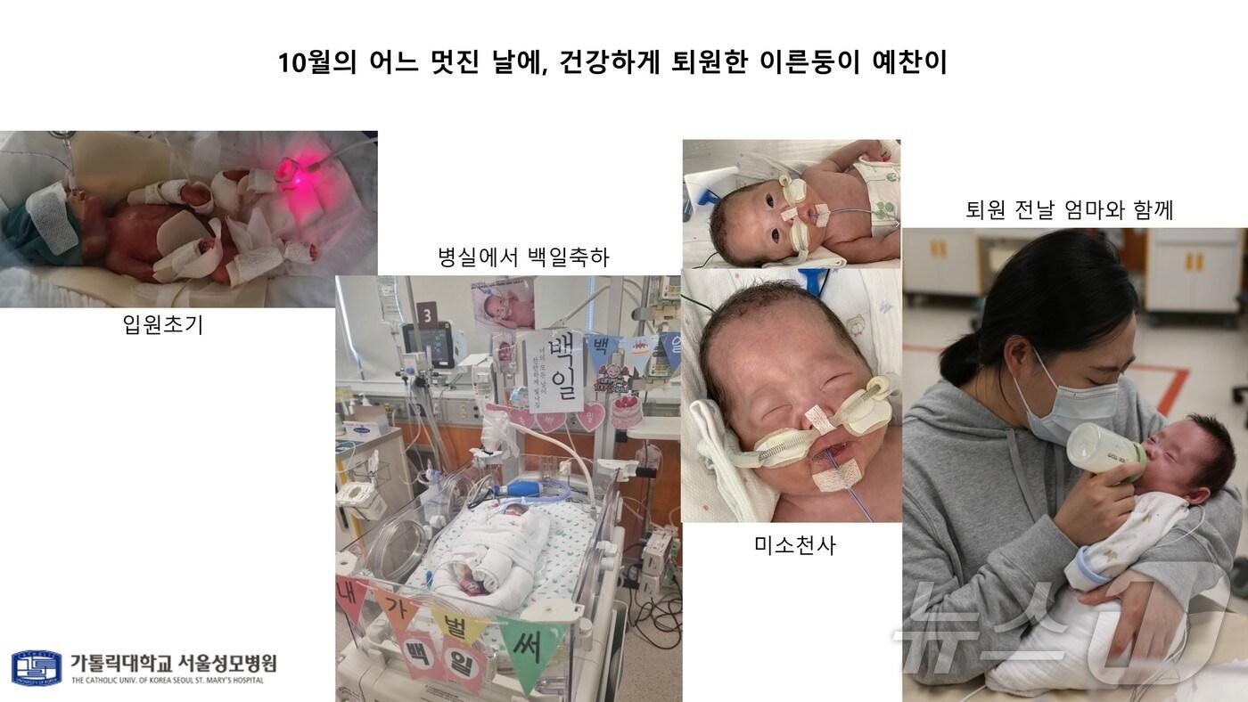 서울성모병원에서 512g으로 태어난 예찬이 성장과정 (서울성모병원 제공) 2024.10.30/ 뉴스1 ⓒ News1