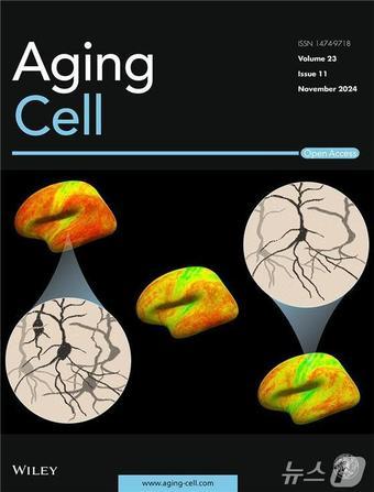본문 이미지 - 이한 솔 박사의  하버드 의과대학 연구진이 발표한  인간의 수명 전반에 걸친 피질 미세구조의 변화를 정밀하게 분석한 연구 논문이 실린 노화생물학  전문 학술지 Aging Cell.