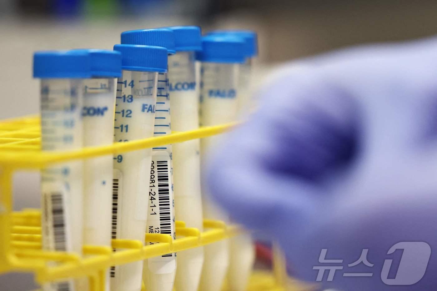 2024년 12월 10일 뉴욕 이타카에 있는 코넬 대학교 동물 건강 진단 센터에서 직원이 우유 샘플을 검사할 준비를 하는 모습ⓒ AFP=뉴스1