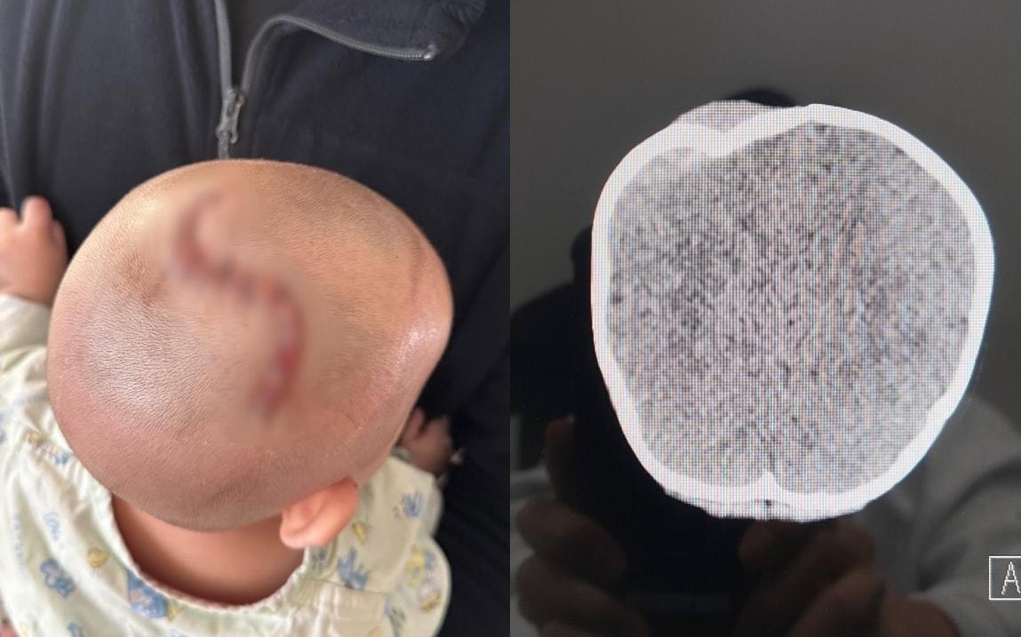 본문 이미지 - (SNS 갈무리)