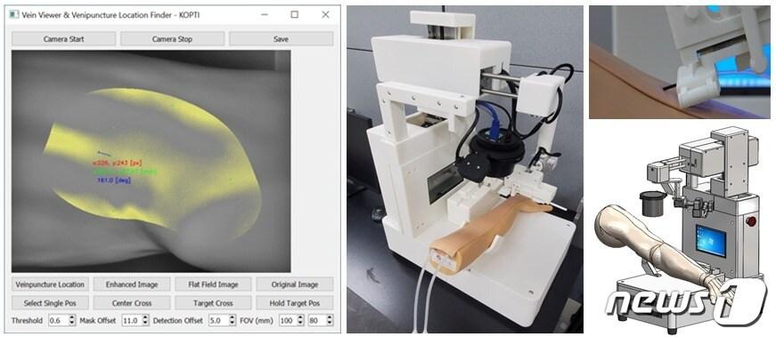 본문 이미지 - 정맥 영상 가이딩 기술을 이용한 고정밀 자동 채혈 로봇&#40;한국광기술원 제공&#41;/뉴스1 