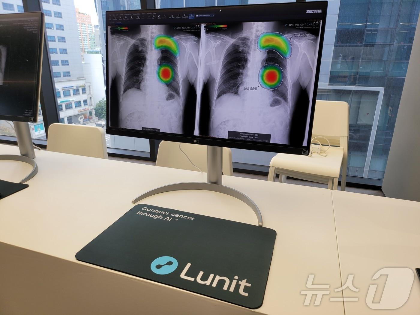 본문 이미지 - 루닛 의료AI '루닛 인사이트 CXR'이 서울 강남구 루닛 본사에서 시연되고 있다./뉴스1 ⓒ News1