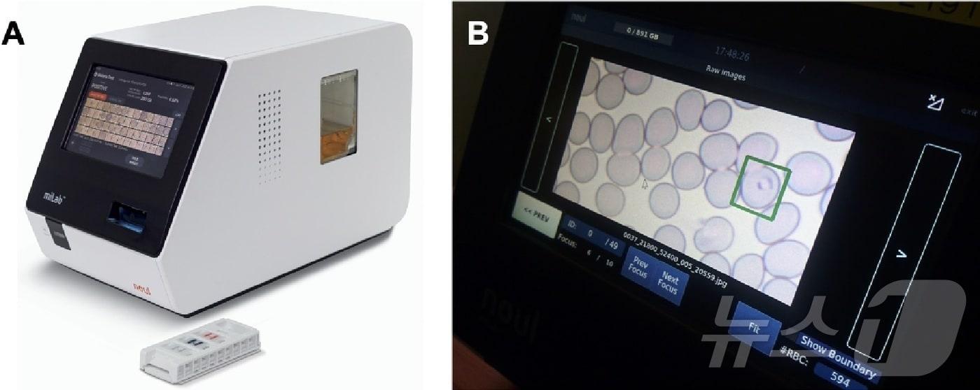 노을의 말라리아 진단기기 마이랩 디바이스와 카트리지 모습. 마이랩을 통해 분석한 기생충 감염 적혈구를 화면에서 직접 볼 수 있다.(노을 제공)/뉴스1 ⓒ News1