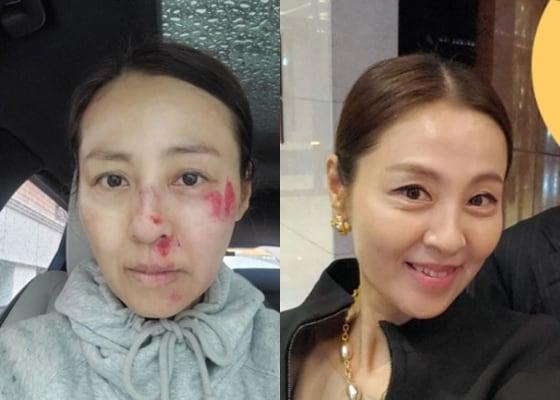 본문 이미지 - 사진=전혜진 인스타그램