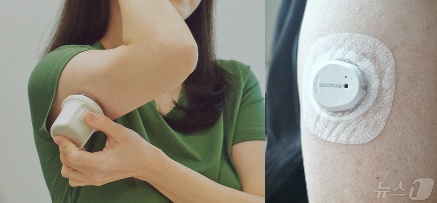 본문 이미지 - 연속혈당측정기 부착방법을 설명한 홈페이지 사진(왼쪽)과 실제 팔에 부착한 모습 ⓒ 뉴스1