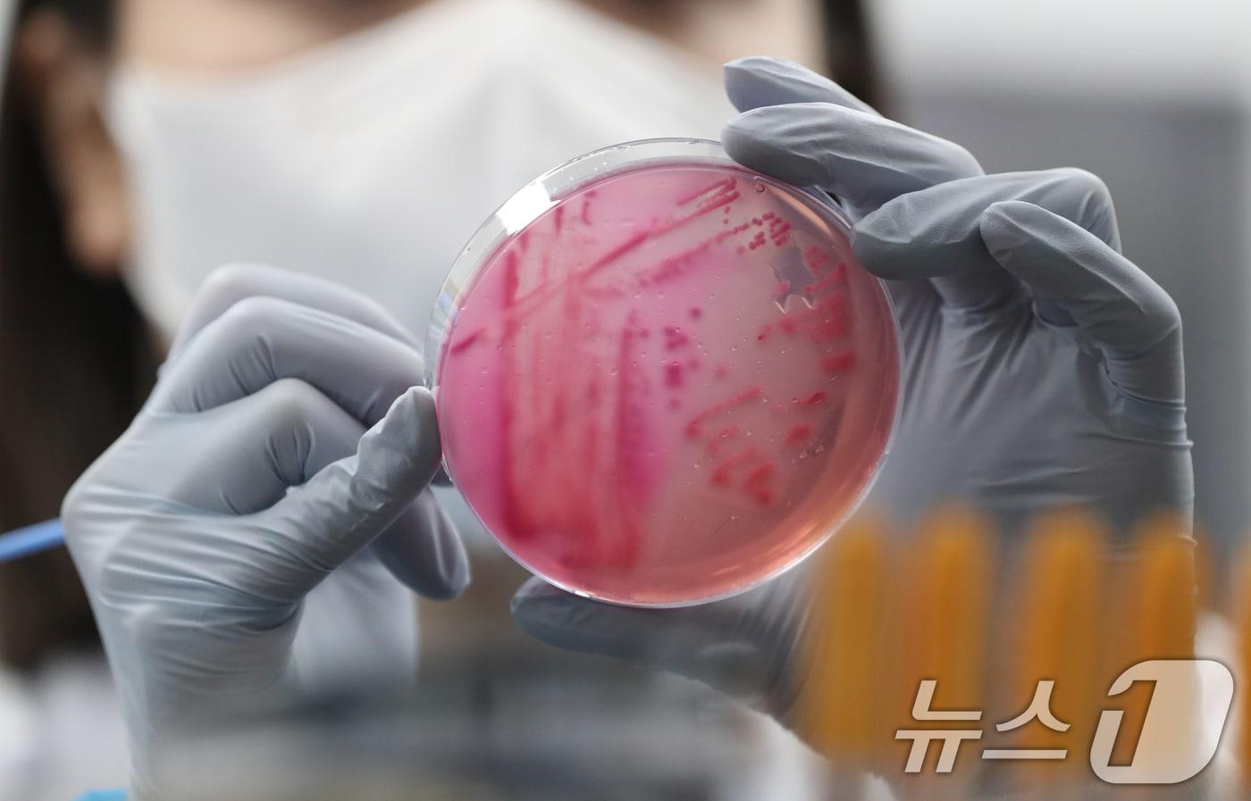 식중독균 배양검사.(사진은 기사 내용과 무관함) / 뉴스1 ⓒ News1 김영운 기자