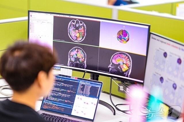 본문 이미지 - 질병관리청 국립보건연구원 소속 연구원이 '뇌 영상 데이터 기반 치매 예측 모델 개발' 관련 업무를 하고 있다. (질병청 제공)