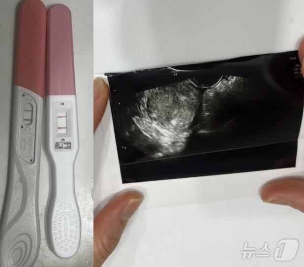 본문 이미지 - (포스타입 갈무리) /뉴스1