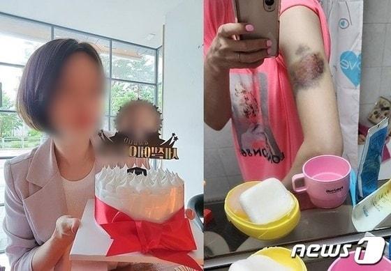 본문 이미지 - 지난해 스토킹하던 전 남자 친구의 흉기에 찔려 숨진 30대 여성 이 모 씨. (온라인 커뮤니티 갈무리) ⓒ 뉴스1