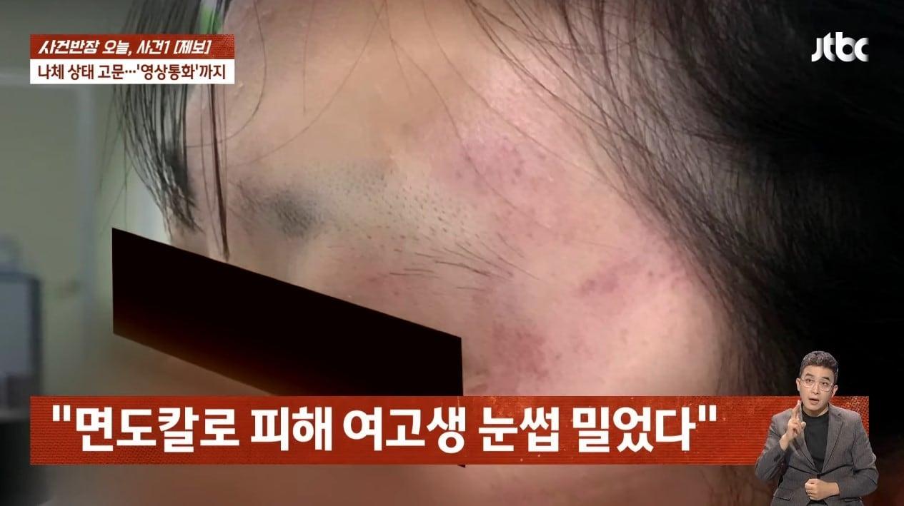 본문 이미지 - (JTBC '사건반장')