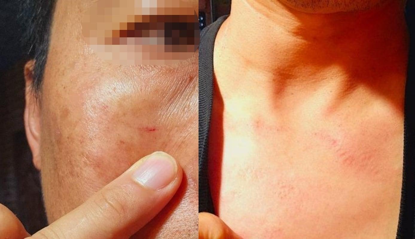 본문 이미지 - &#40;보배드림 갈무리&#41;