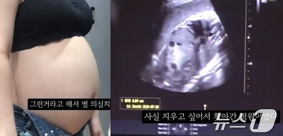 본문 이미지 - 지난달 말 한 유튜버가 임신 36주차 태아의 초음파 사진을 공개하면서 '900만원을 들여 낙태했다'고 밝혀 '영아 살해'논란에 휩싸였다. (유튜브 갈무리) ⓒ 뉴스1 