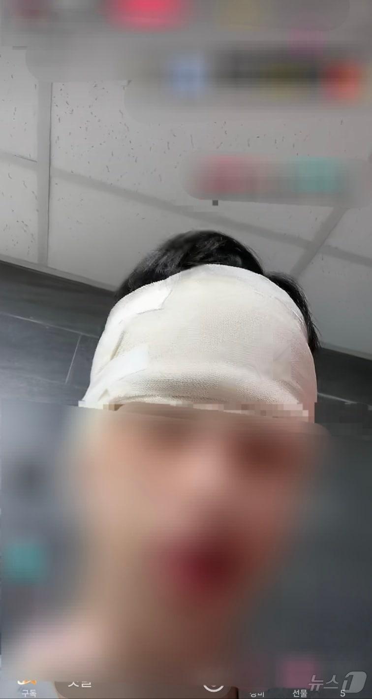 본문 이미지 - 폭행 당한 뒤 A 씨의 틱톡 라이브 방송 화면(SNS 갈무리)/뉴스1