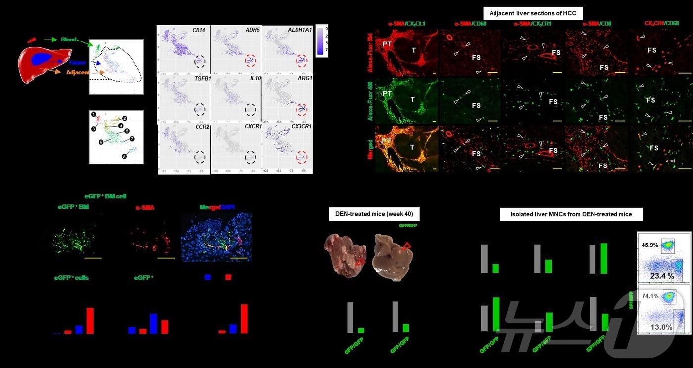 본문 이미지 - 간암 환자의 간 조직을 이용한 단일세포유전체 분석.(KAIST 제공)/뉴스1