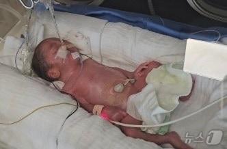 본문 이미지 - 동두천시에 거주하는는 교육공무원 부부가 출산한 다섯 쌍둥이 중 첫째가 갓 태어난 모습(사진=친할머니 제공).