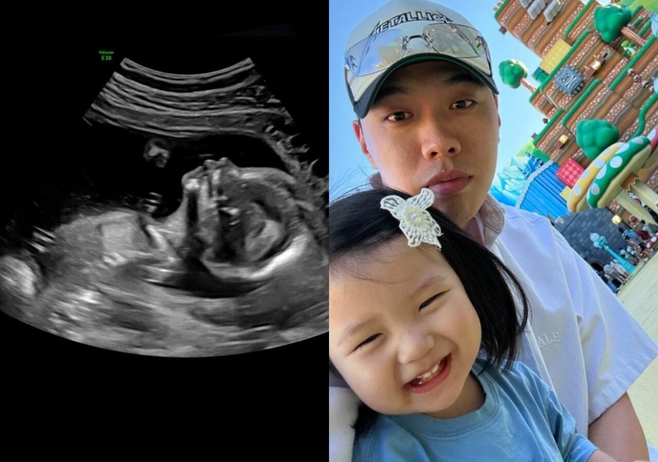 본문 이미지 - 비와이 인스타그램