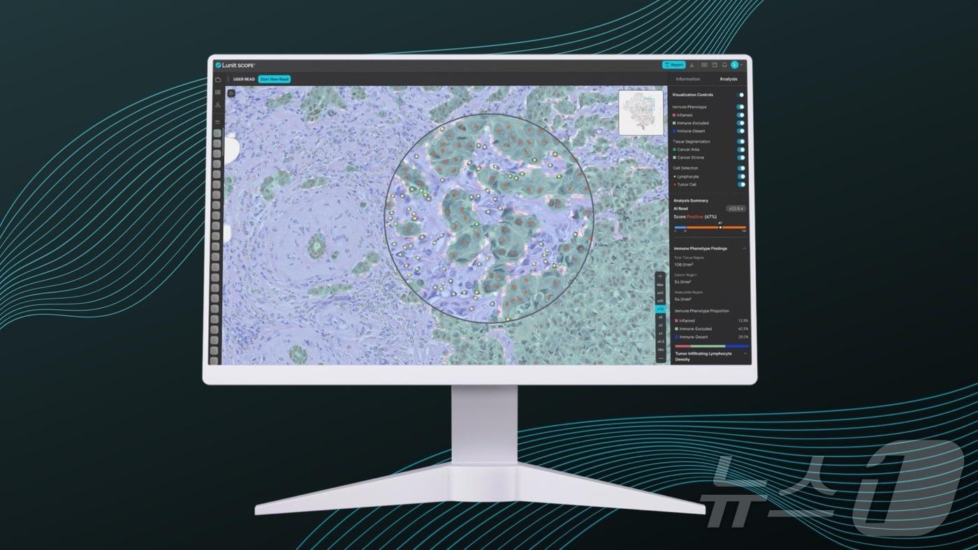  루닛 스코프.(루닛 제공)/뉴스1 ⓒ News1