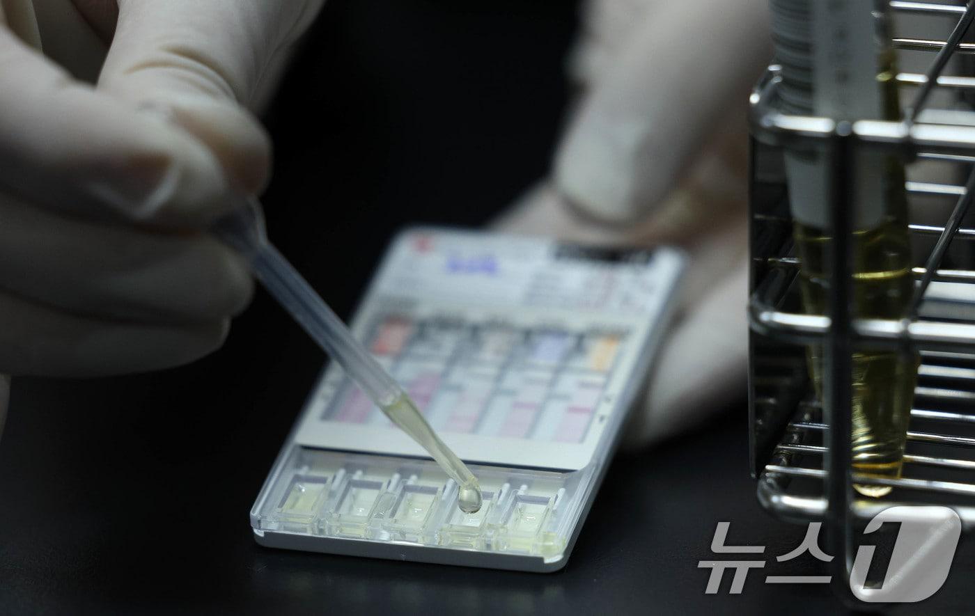 13일 오전 서울 영등포구 서울지방병무청 제1병역판정검사장에서 임상병리사가 소변을 검체로 간이 검사 키트를 활용해 마약 검사를 하고 있다. (사진은 기사 내용과 무관함) / 뉴스1 ⓒ News12025.1.13/뉴스1 ⓒ News1 박세연 기자 